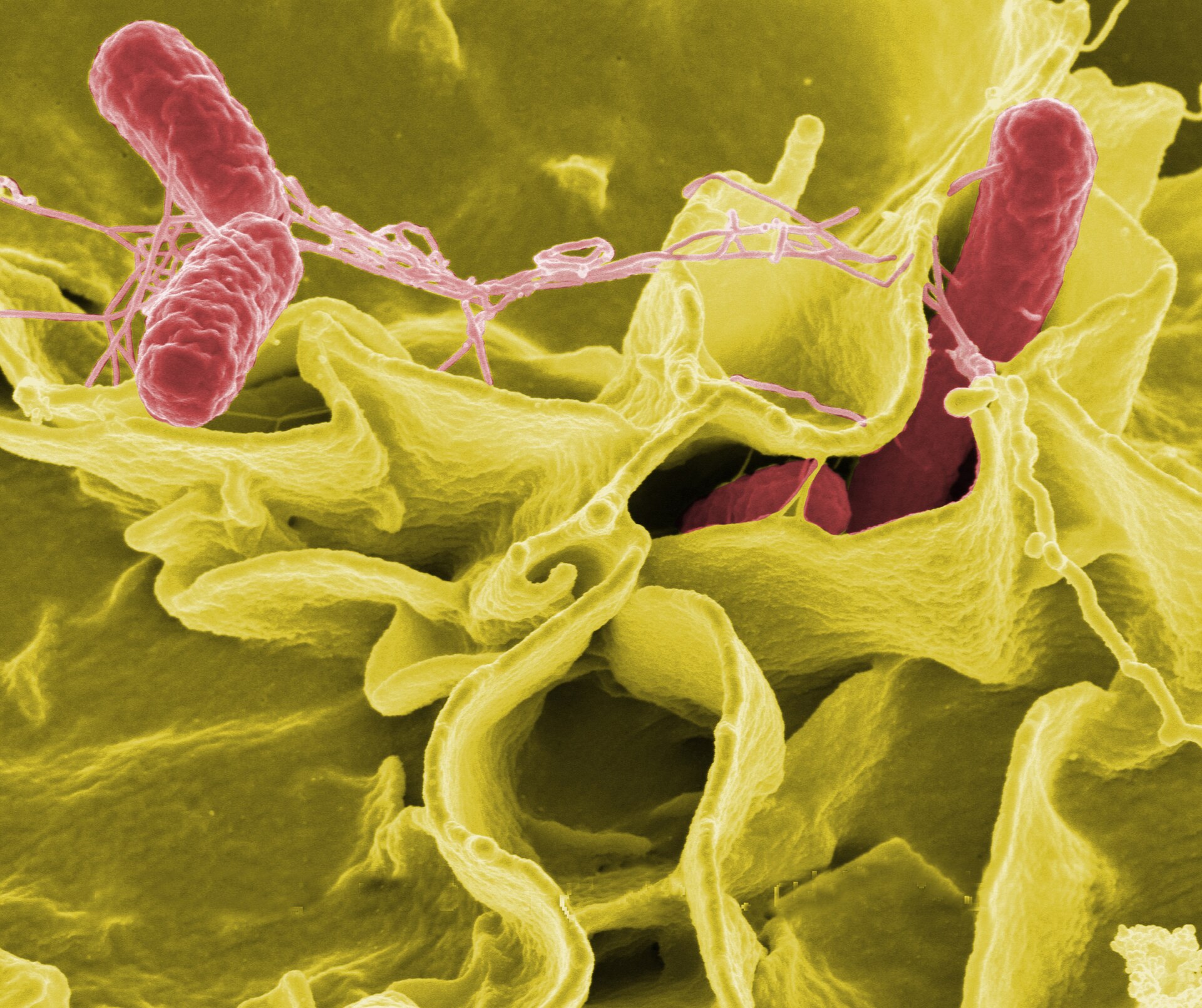 Imagem de referência de Salmonella, descrito nos dados abertos como género de bactéria