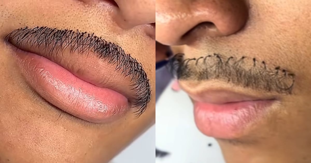 Bigode de cílios? Homem viraliza ao apostar em procedimento estético inusitado