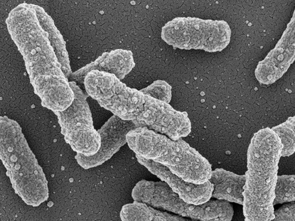 O que se sabe sobre a suspeita de peste pneumônica na Rússia