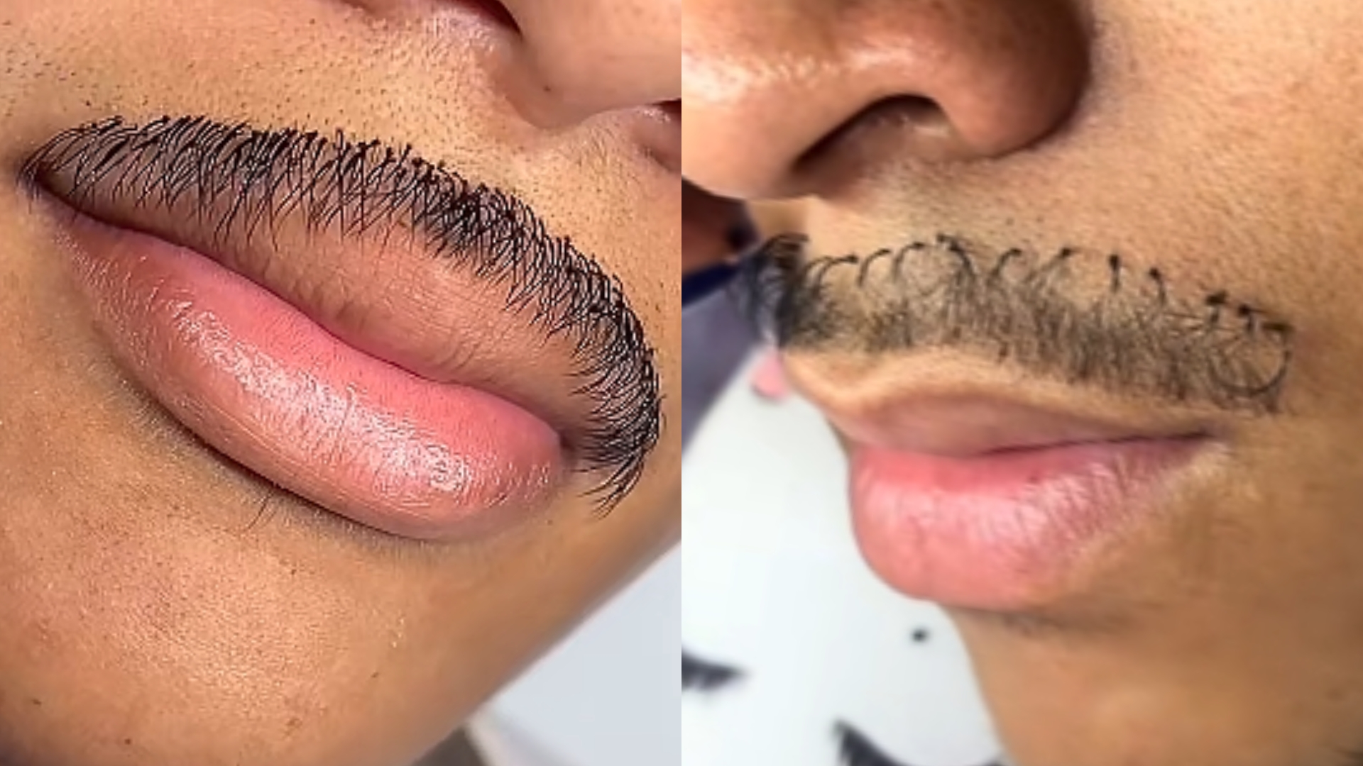 Bigode de cílios? Homem viraliza ao apostar em procedimento estético inusitado